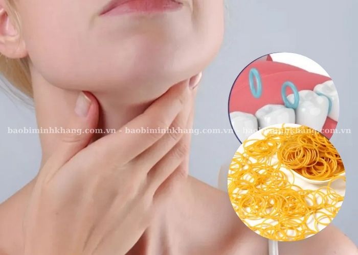 Nuốt dây thun có sao không? Tùy loại dây thun sẽ có mức độ nguy hiểm khác nhau